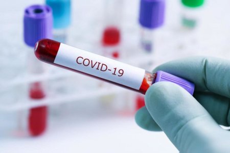 Azərbaycanda daha səkkiz tibb işçisi koronavirusa yoluxdu - AÇIQLAMA